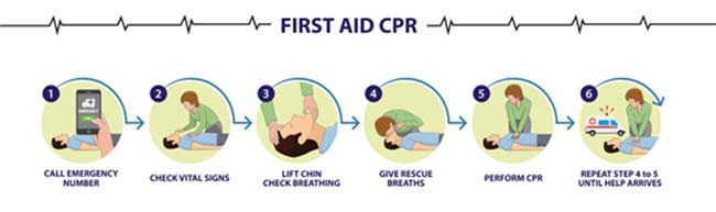 Things to consider before CPR